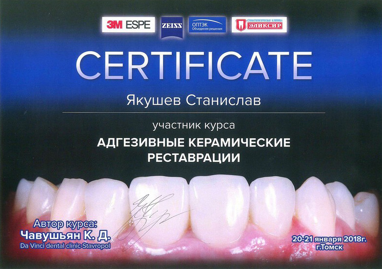 award